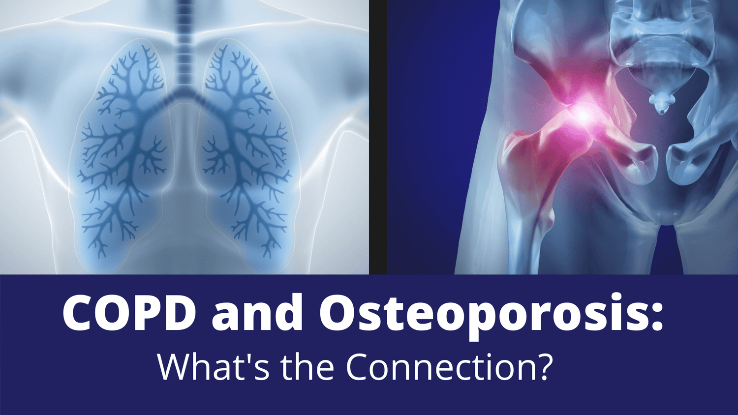 COPD and Osteoporosis: What's the Connection?